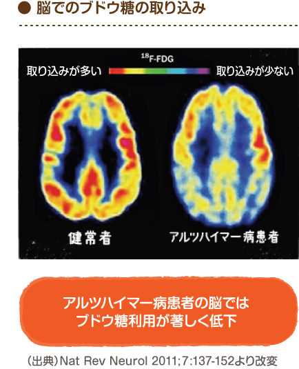 Mctサロン 脳の栄養不足を助ける Mct Mctサロン 脳の栄養不足を助ける Mct